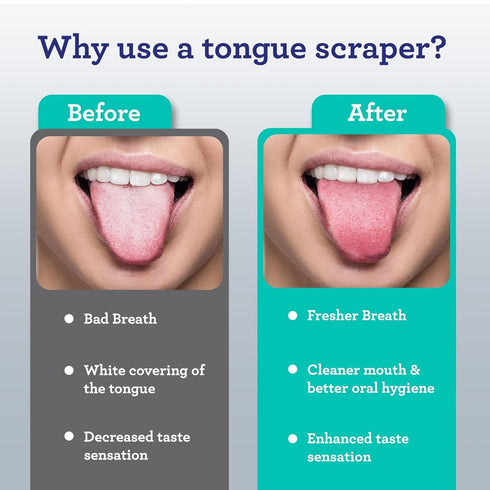 GuruNanda Tongue Scraper for Adults (4-Pack) with Travel Case, 420 Medical Grade Stainless Steel, Aids in Fresh Breath & Oral Care - Travel-Friend...