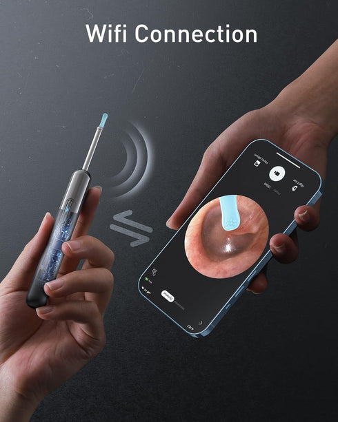 Ear Wax Removal - Wireless WiFi Rechargeable Ear Cleaner, Hassle-Free Instant Removes Ear Wax, 1080P HD Camera Lens & 8 Pcs Ear Set - Ear Cleaning...