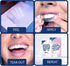 Whitening Strips, Teeth Whitening Strip, 28 Strips for Sensitive Teeth, Professional and Safe Teeth Whitening Kit Cherry Blossom?14 Treatments...