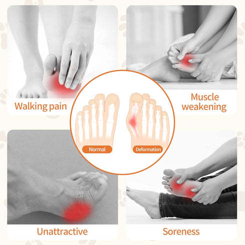 2 Pairs Gel Metatarsal Pads Men Women Honeycomb Fabric Forefoot Pads High Heels Comfort Pads Soft Ball of Foot Cushions Inserts for Pain Relief No...