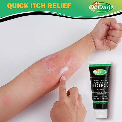 Dr. Dan's Hydrocortisone Hand and Body Lotion- 3 Pack- Anti Itch Lotion for Men and Women...