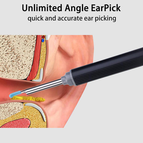 Ear Wax Removal with Camera - High-Definition Ear Health Monitor for iPhone, iPad & Android Phones...