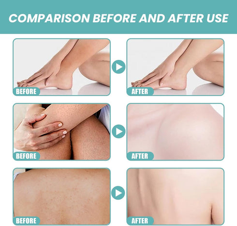 Smooth Skin Bath Oil,Skin so Soft Original Bath Oil,3.4 fl.oz.Skin Bath Oil,Skin Moisturizing Bath Oil,Original Skin Bath Oil for Body Using,Skin ...