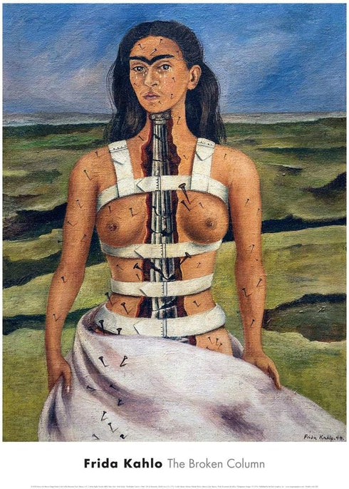 McGaw Graphics The Broken Column, 1944 by Frida Kahlo, Wall Art Print Poster, Paper Size 24" x 18" Image Size 21" x 16.5" (1157)...