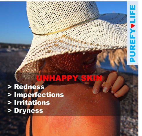 Topical Spray (3.4oz) Soothing Face & Body Skin Spray, Purefypro Dermal HOCL Technology, Natural Skincare Support Redness, Irritations, Eyelid Eye...