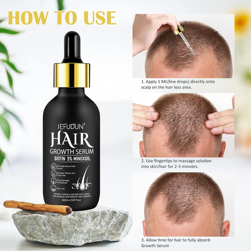 5% Minoxidil Hair Growth Serum,Minoxidil Hair Growth, Hair Loss and Hair Regrowth Oil With Biotin Hair Regrowth Treatment for Scalp Hair Loss Hair...