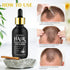 5% Minoxidil Hair Growth Serum,Minoxidil Hair Growth, Hair Loss and Hair Regrowth Oil With Biotin Hair Regrowth Treatment for Scalp Hair Loss Hair...