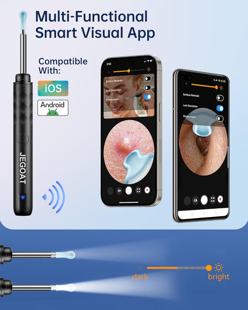 Ear Wax Removal Tool Camera, Ear Cleaner with Camera, 1296P HD Ear Scope, 6 LED Lights and 12 Ear Picks, Earwax Removal with Otoscope, Jet Black...