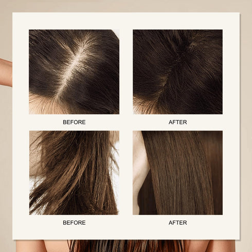 Rosemary Oil for Hair Growth, Hair Growth Oil, Hair Oils for Hair Growth, Rosemary Hair Oil, Hair Treatment Oils for Repairing Hair, Relieving Dry...