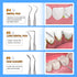 Dental Tools, Sopito 11PCS Teeth Cleaning Tools Stainless Steel Dental Scraper, Home Use Basic Dental Tool Set...