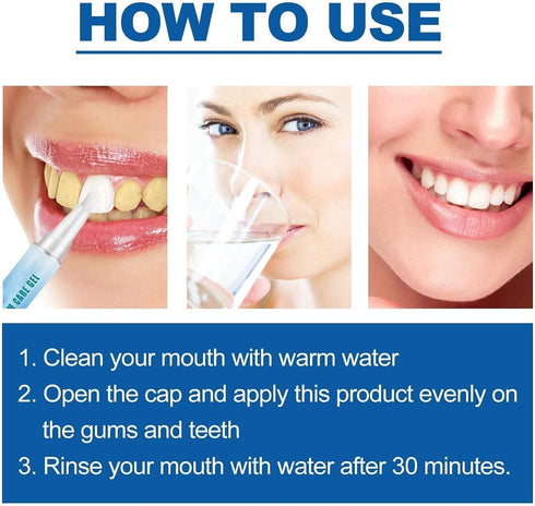 Frosty Neptune Teeth Whitening, Frosty Neptune Teeth Whitening Essence, Fast and Effective Removal Tooth Stain, Reduce Yellowing Teeth Whitening G...