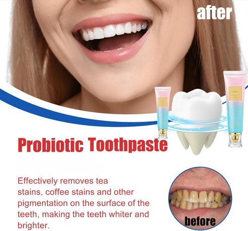 2PCS Nicotinamide Toothpaste, Bulk Toothpaste,Fresh Breath Toothpaste,Fluoride Free Toothpaste...