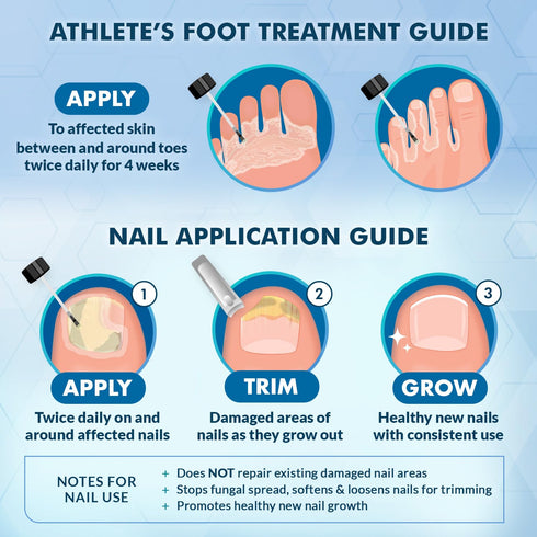 Ebanel Athlete's Foot Fungus Treatment Extra Strength, Antifungal Cream with Miconazole, Undecylenic Acid, Tea Tree Oil, Treats Skin Fungi Leading...