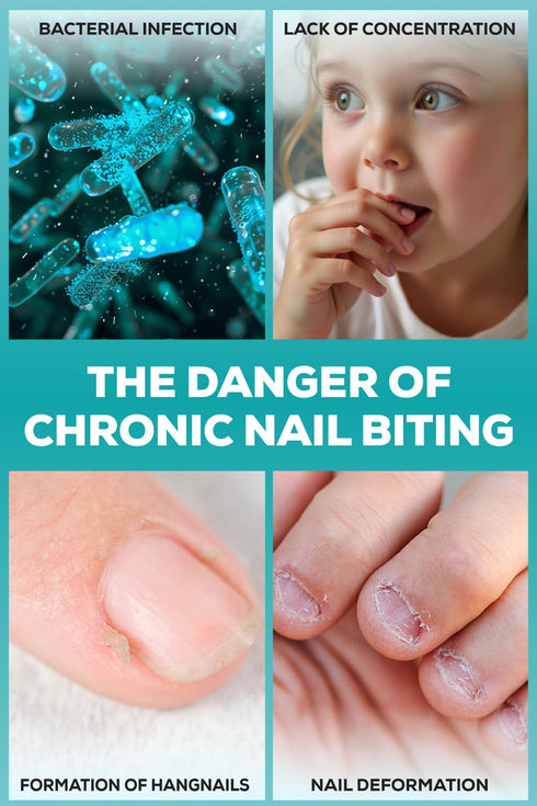 Nail Biting Prevention for Kids - Thumb Sucking Deterrent for Kids, Toddlers, Children - No Bite Nail Polish Pen - Bitter Taste - Safe & Effective...