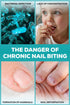 Nail Biting Prevention for Kids - Thumb Sucking Deterrent for Kids, Toddlers, Children - No Bite Nail Polish Pen - Bitter Taste - Safe & Effective...
