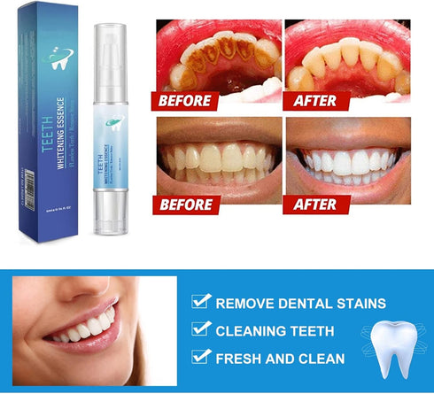 3Pcs Teeth Whitening Pen,Teeth Whitening Gel,Teeth Whitening Essence Pen,Intensive Teeth Stain Remover,Reduce Yellowing Oral Care for Women & Men....