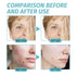 Face Moisturizer Collagen & Retinol Cream with Hyaluronic Acid, Anti Aging Face Cream, 1.7oz...