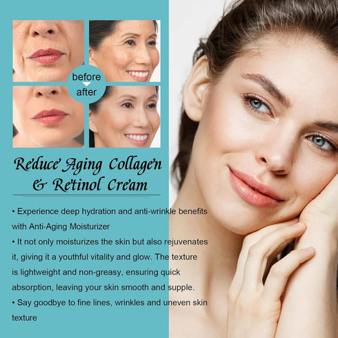 Face Moisturizer Collagen & Retinol Cream with Hyaluronic Acid, Anti Aging Face Cream, 1.7oz...