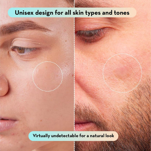 LE GUSHE K-BEAUTY Pimple Patches for Face (78 dots) - Hydrocolloid Acne Patch for Zits and Blemishes - Invisible Blemish Patches | Spot Cover Stic...