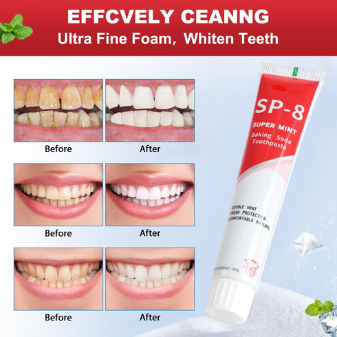 2PCS SP-8 Ultra Whitening Toothpaste, SP 8 Probiotic Toothpaste, SP-8 Toothpaste, SP8 Probiotic Brightening Toothpaste, Super Deep Clean Super Fre...