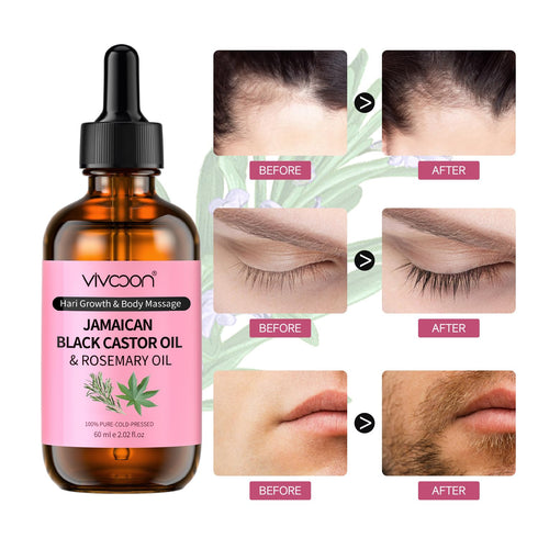 Jamaican Black Castor Oil with Rosemary, Black Castor Oil Cold Pressed, Organic Castor Oil for Hair Growth, Eyelashes and Eyebrows Growth, Castor ...