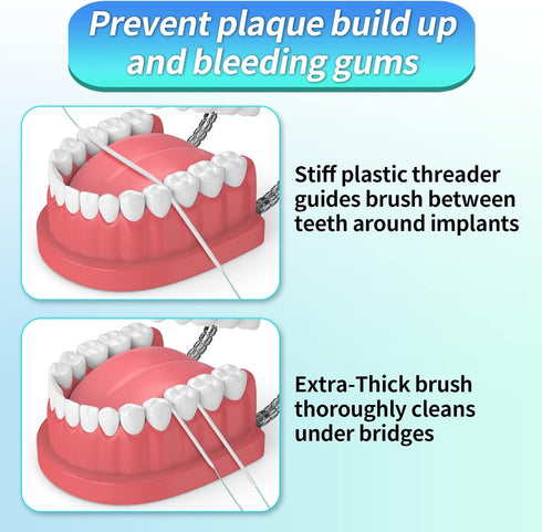 Easy-to-Use Sponge Floss for Cleaning of Implants Bridges with Stiff Plastic Ends and Sponge Floss Oral Hygiene (2)...