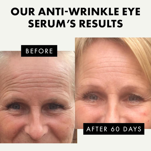 ?????? ????????* Eye Serum - Under Eye Cream for Dark Circles and Puffiness - Anti Aging Eye Cream, Under Eye Brightener Eye Bags Eye Treatment, C...