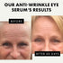 ?????? ????????* Eye Serum - Under Eye Cream for Dark Circles and Puffiness - Anti Aging Eye Cream, Under Eye Brightener Eye Bags Eye Treatment, C...
