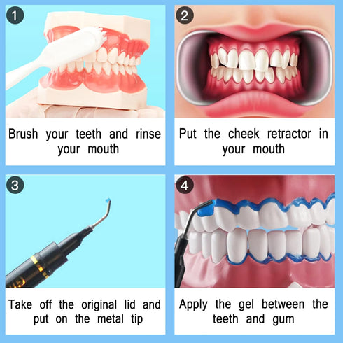 Dental Gingival Barrier Protection Gel, 10PCS 3ML Gum Protector Gel for Teeth Whitening...