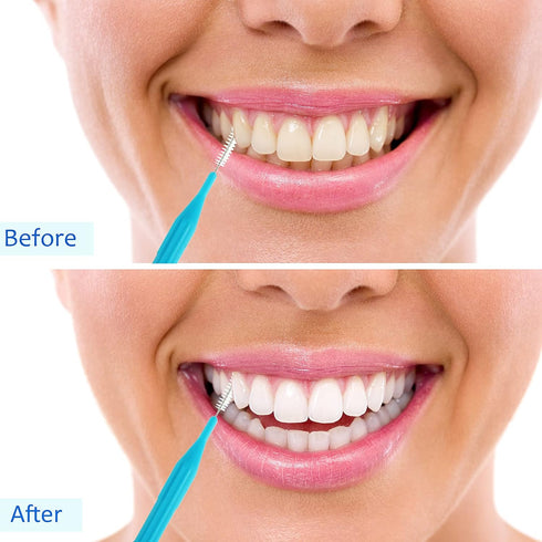 50 Pieces Braces Brush for Cleaner Interdental Brush Toothpick Dental Flossing Head Oral Hygiene Flosser Tooth Cleaning Tool...