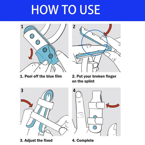 Flexible Portable Aluminum Finger Splint Set?Aluminum Finger Splint Adjustable, for Sprained Swollen Fingers Straightening Arthritis Pain Relief...