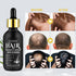 5% Minoxidil Hair Growth Serum,Minoxidil Hair Growth, Hair Loss and Hair Regrowth Oil With Biotin Hair Regrowth Treatment for Scalp Hair Loss Hair...