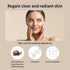 BENTON Snail Bee Ultimate Serum Plus 35ml (1.18 fl.oz.) - Snail Secretion Filtrate, Bee Venom, Tea Tree Leaf Water Contained Skin Nourishing & Soo...