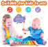 MCPINKY Xylophone for Kids, Xylophone Musical Toy with Child Safe Mallets Educational Musical Instruments Toy for Toddlers 1-3...