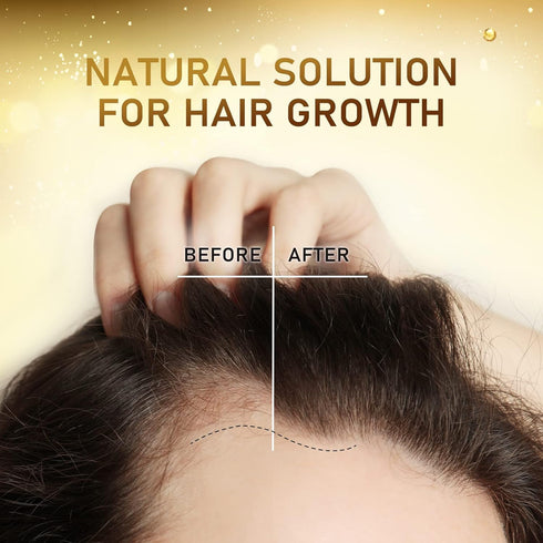 Biotin Hair Growth Serum with Castor Oil, Argan Oil - Hair Loss Prevention Treatment with Hair Regrowth Formula for Women by Beaueli...