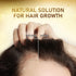 Biotin Hair Growth Serum with Castor Oil, Argan Oil - Hair Loss Prevention Treatment with Hair Regrowth Formula for Women by Beaueli...