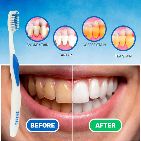 Sensation Expert Toothbrush with Care Cap, Removes Plaque and Surface Stains, Ergonomic Rubber Handle, Soft Bristles, Ideal for Adults, 8 Count (P...