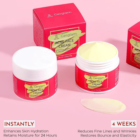 Acne Spot Treatment for Face - Advanced Acne Cream with Salicylic Acid, Pimple and Blemish Spot Treatment, Cystic Acne Treatment & Acne Medication...
