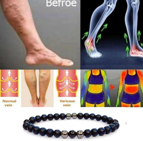 Anti Swe_lling Black Obsidian Anklet, Adjustable We_ight Loss Anklet Black Bracelet, Feng Shui Black Obsidian Anklet for Foot Pain Relief Jewelry ...
