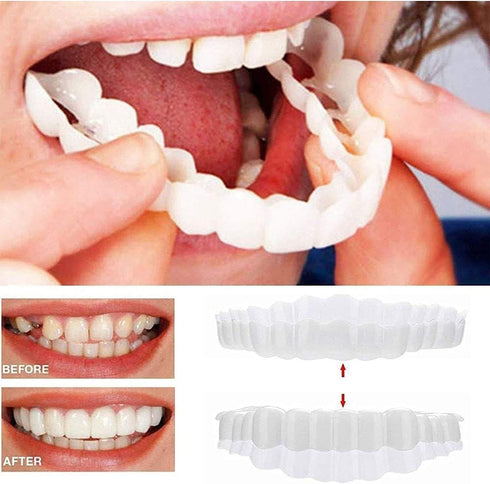 2 Pairs,Men's and Women's Temporary Cosmetic Confident Smile...