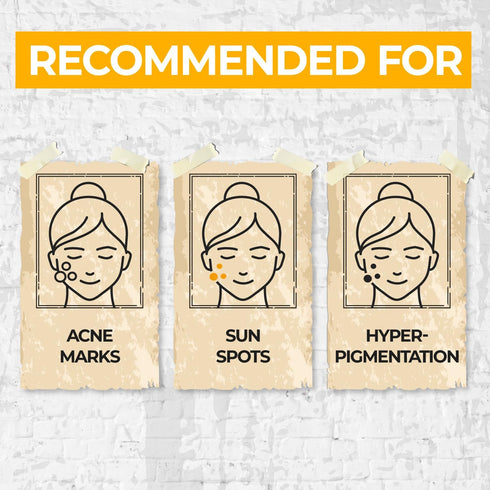numbuzin No.5+ Vitamin Concentrated Serum | Glutathione & Vitamin Serum, Dark Spot, Korean Skincare 1.01fl.oz/30ml...