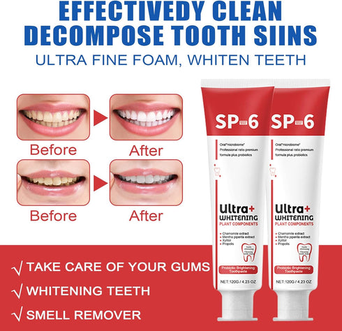 Sp-6 Ultra Whitening, Sp 6 Toothpaste 2pcs?probiotics whitening toothpaste,Deep Cleaning Care Toothpaste,Fresh Breath Toothpaste Brightening & Sta...