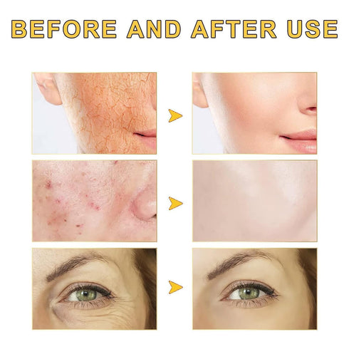 Snail Mucin Serum 96% / Power Repairing Essence 3.38 fl.oz(100 ml) / Hydrating Serum for Face with Snail Secretion Filtrate for Dull Skin & Fine L...