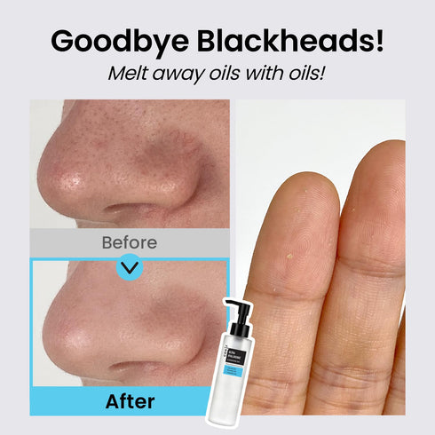 coxir ULTRA HYALURONIC CLEANSING OIL l Korean Facial Cleanser, Blackhead Makeup Removal with Hyaluronic Acid, Cruelty Free, No Mineral Oil [5.07 F...