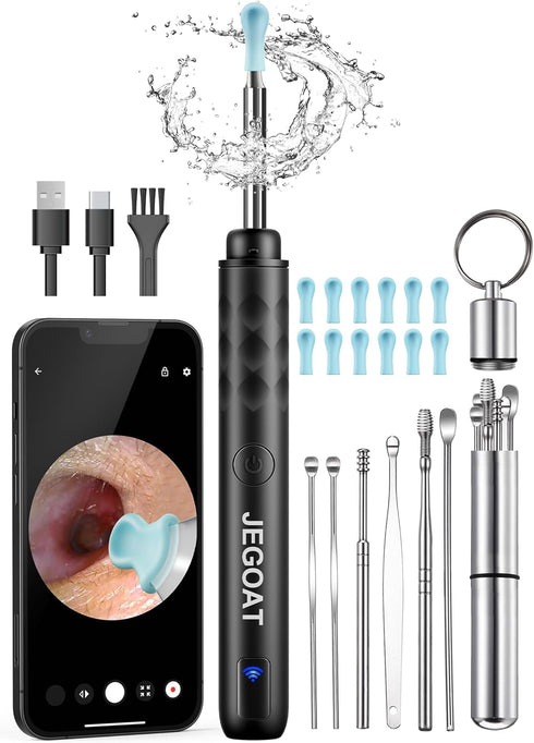Ear Wax Removal Tool Camera, Ear Cleaner with Camera, 1296P HD Ear Scope, 6 LED Lights and 12 Ear Picks, Earwax Removal with Otoscope, Jet Black...