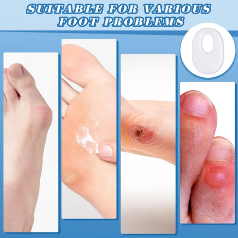 WILLBOND 120 Pcs Callus Pads Soft Felt Callus Oval Shape Corn Pads for Bottom of Foot Adhesive Foot Corn Pads for Men and Women Feet Toes Heel Pai...