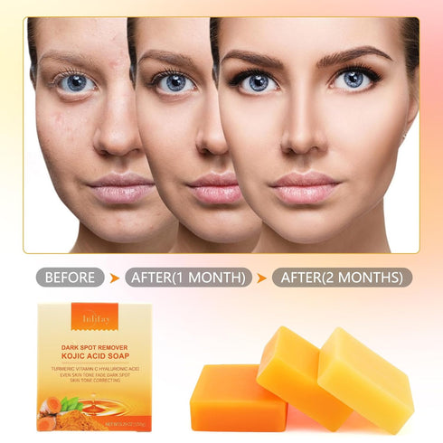Inlifay Kojic Acid Soap Dark Spot Remover : Turmeric Soap with Vitamin C, Vitamin E, Retinol, Collagen, Hyaluronic Acid, Moisturizing for Body & F...