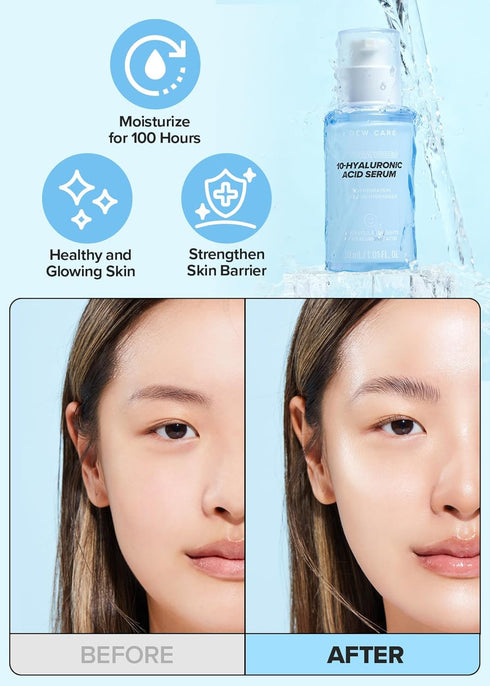 I DEW CARE Hydra Vibes 10-Hyaluronic Acid Serum | Hyaluronic Acid Water-gel Serum, Jeju Hydrangea, Moisturizing, Glass Skin, Korean Skin Care, Veg...