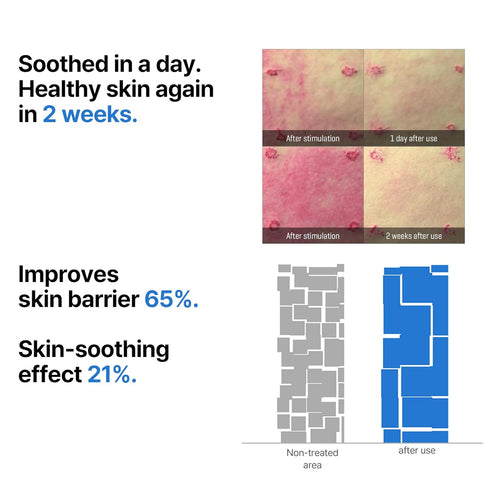 SOME BY MI Renewed Beta-Panthenol Repair Serum - 1.01Oz, 30ml – Rebuilding Skin Barrier with Beta-Sitosterol and Panthenol – Daily Face Serum for ...