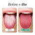 Wipe Tongue Fresh Tongue Scraper for Adults | 100% Stainless Steel Tongue Scraper Oral Care | Tongue Cleaner | Oral Hygiene Essentials Tongue Scru...